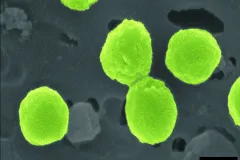 neon green closeup of prochlorococcus