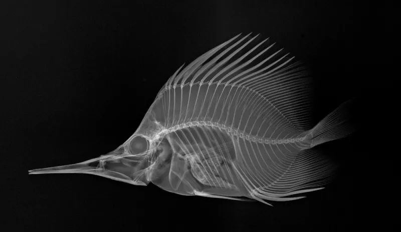 X-ray image of a longnose butterflyfish