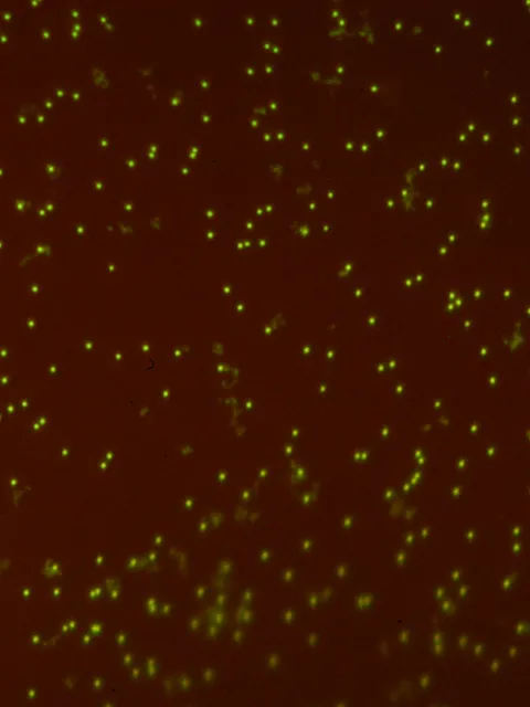 Black background with hundreds of green dots that indicate a cyanophage.